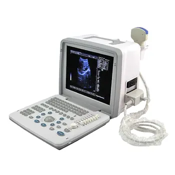 LTUB62 Lacné Prenosné Vypuklé Sonda Tehotenstva Notebook LED Digitálne B/W Doppler Lekárske Ultrazvukové Nástroje